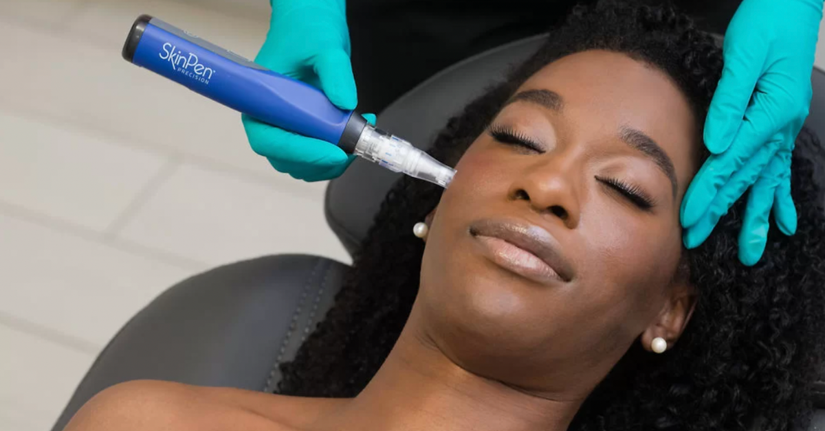 Want Smoother, Clearer Skin? SkinPen Microneedling Is the Upgrade You Need