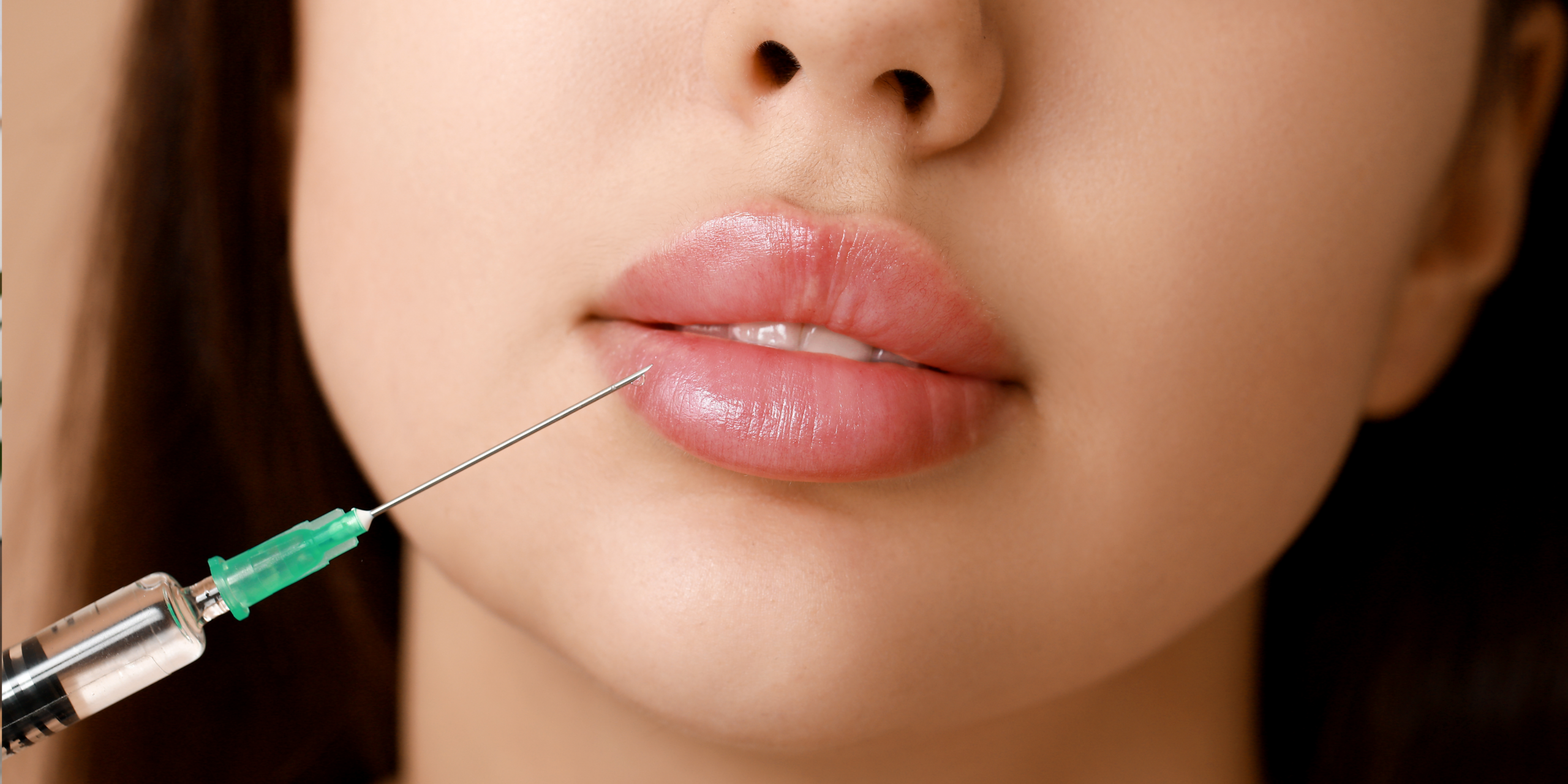 Lip Flip vs Lip Filler: Which One Gives You the Look You Actually Want?